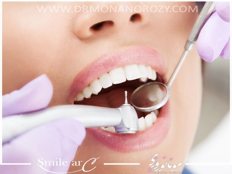 علت مراجعه به متخصص دندانپزشک زیبایی و ترمیمی چیست؟